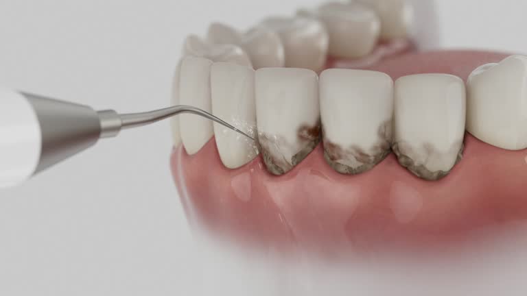 Trusted Teeth Cleaning And Checkup service in Middletown, CA - Dentist Open Now